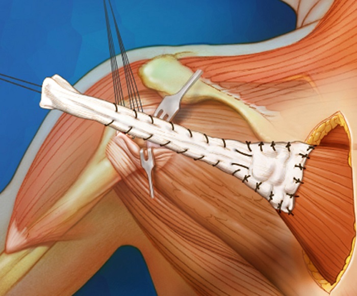 AVS PLASTIC SURGERY AND SKIN CLINIC Pudukkottai